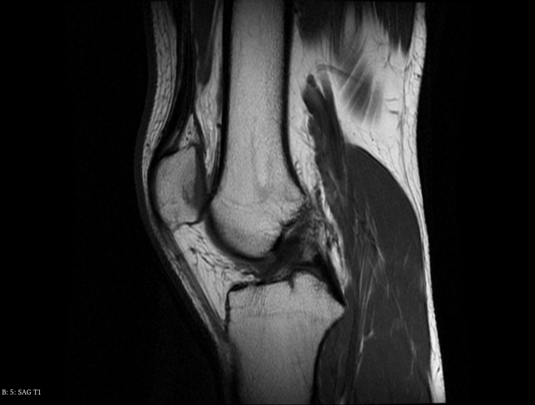 rodilla screenshot rodilla screenshot